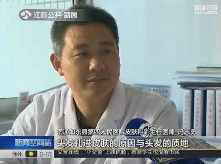 头发被传染奇痒难耐怎么办啊,头发丝不光滑是什么原因