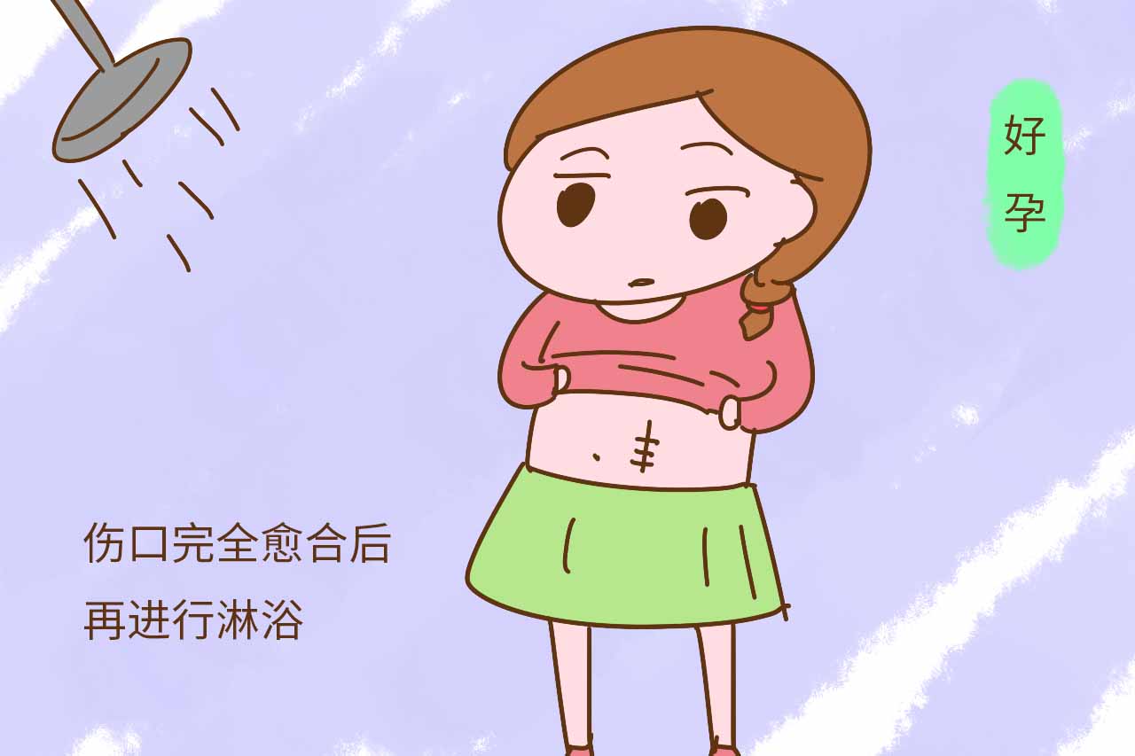 生完孩子之后，你多久开始洗澡的？这让夏天坐月子的妈妈怎么活