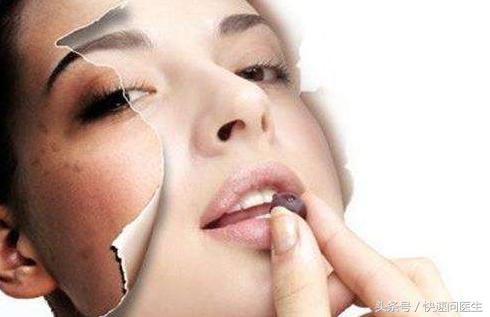 如何淡化雀斑或者去除雀斑,怎么可以淡化脸上的雀斑
