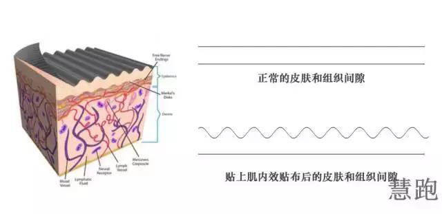 服务奥运冠军的运动防护大咖老师教你正确使用肌贴