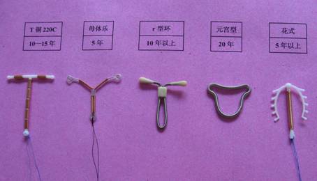 What?上环都能怀孕！千万别认为上了环就可以高枕无忧了