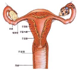 女性痛经的缓解办法,女性痛经是几级疼痛