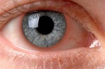 强直性脊柱炎引起虹膜炎,虹膜炎与强直性脊柱炎会失明吗