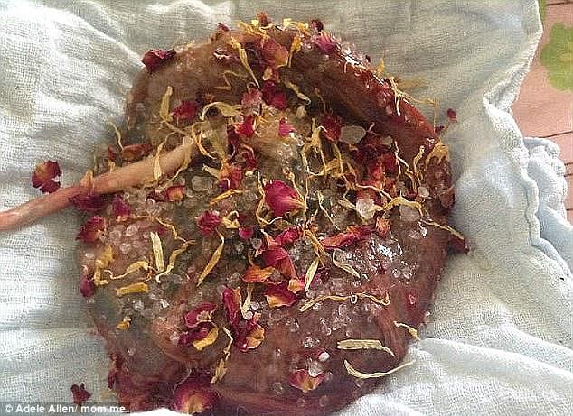 莲花分娩的好处,自然分娩的十种方法