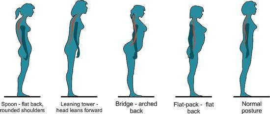 办公室久坐腰痛锻炼,久坐办公室腰痛怎么办