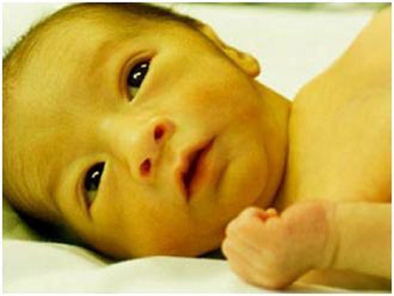 满月黄疸退了又升是怎么回事,满月了黄疸还没退需要停母乳吗