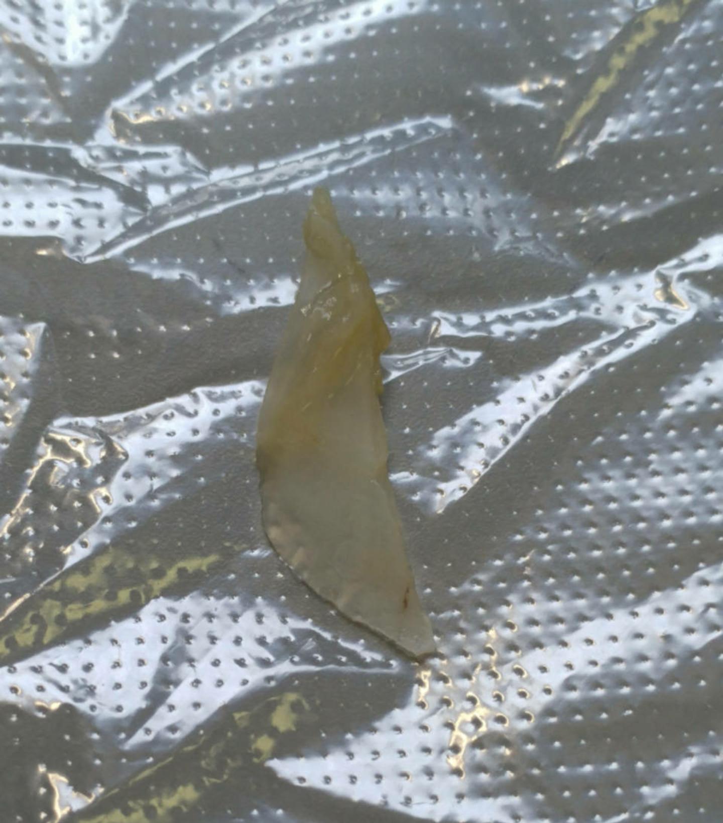 被鱼骨头卡住喉咙最有效方法,骨头卡住食道有什么表现