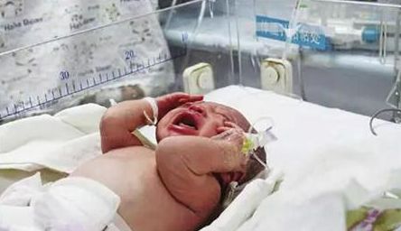 坐着上厕所容易生女儿吗,女子在厕所生下双胞胎原因