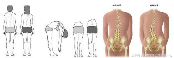 青少年腰痛膝盖痛,青少年腰痛一般是因为什么