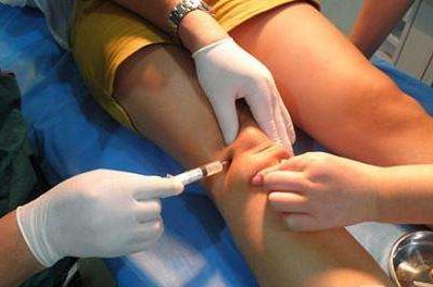 膝关节积液怎么处理最好,膝关节囊内少量积液