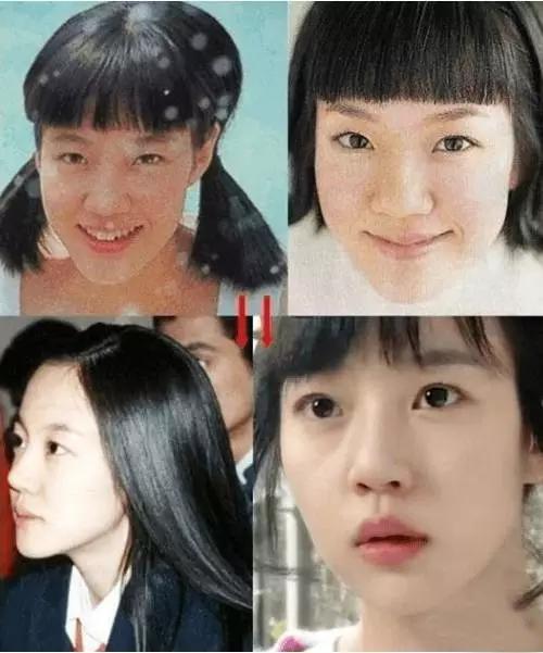 鼻子垫的太往上了,鼻子垫得不高是不是不容易歪