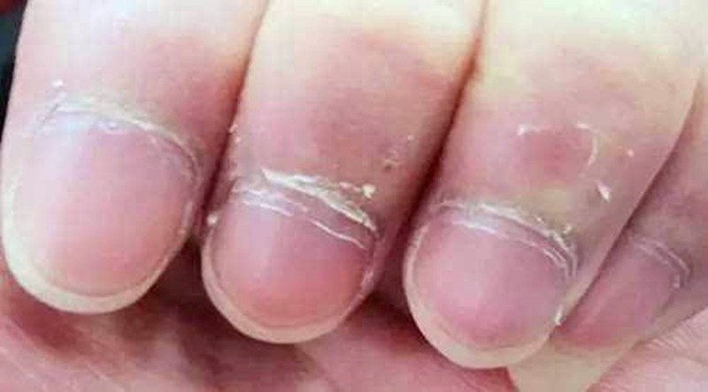 要怎么做才能让宝宝远离危险,宝宝为什么容易得甲沟炎