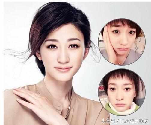 整完容真的美吗?明星整容前后对比图,没对比没伤害!