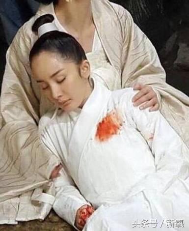 杨幂发际线还会回归吗,杨幂发际线秃到后脑勺