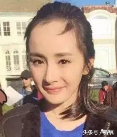 杨幂发际线还会回归吗,杨幂发际线秃到后脑勺