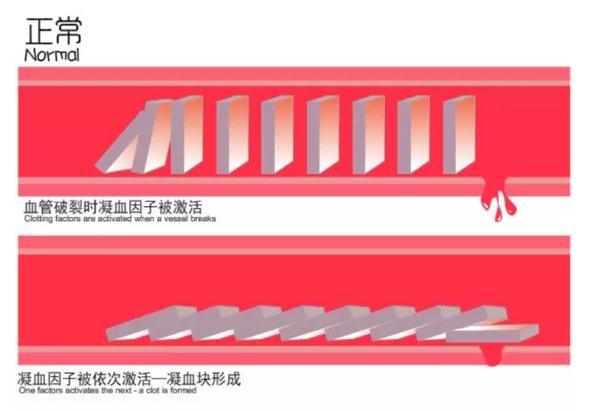 有血友病遗传生孩子有什么危险,一受伤就血流不止的病叫什么