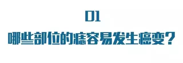长在什么地方的痣易癌变,每一个痣都是代表疾病吗