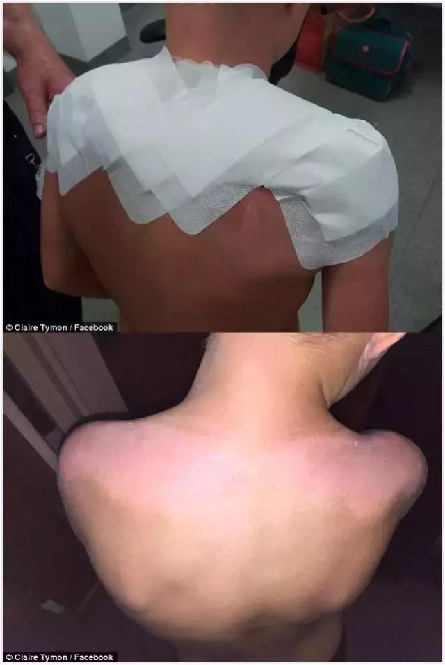 香蕉船防晒霜儿童可以用吗,香蕉船防晒霜用了脸刺痛