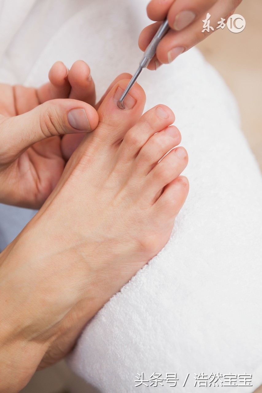 小孩得灰指甲很严重怎么办,儿童有灰指甲对孩子有啥影响吗