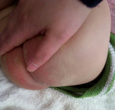 宝宝爽身粉事件,婴儿爽身粉什么成分好