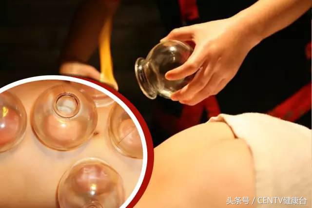 拔罐后罐印痒痒的是怎么回事,拔罐后皮肤发痒怎么回事