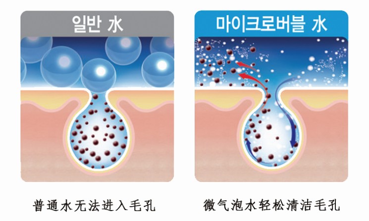 如何快速去除黑头,如何快速去除黑头和痘痘