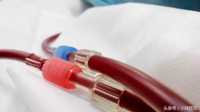 血液透析肾友有奖问答,肾友血液透析