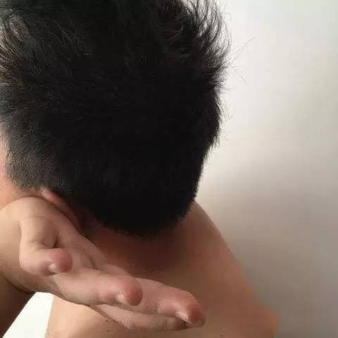 耳朵进水出不来了怎么办,耳朵进水一直出不来怎么办