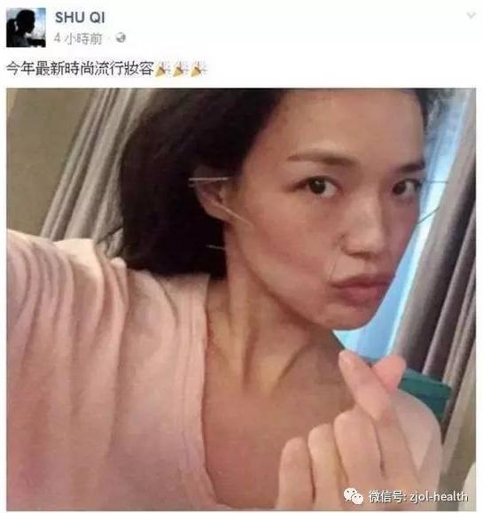 舒淇满脸扎针自拍称治疗过敏！中医治病，厉害的不止针灸还有这些……