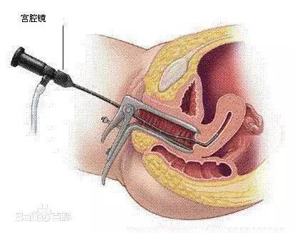 纱布门事件真相,纱布门事件新闻