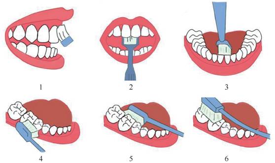 小心“牙”——来自华西口腔医院专家的权威解答