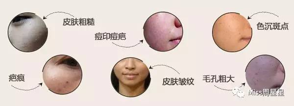 iluminage激光美容仪用法,面部提升紧致美容仪iluminage