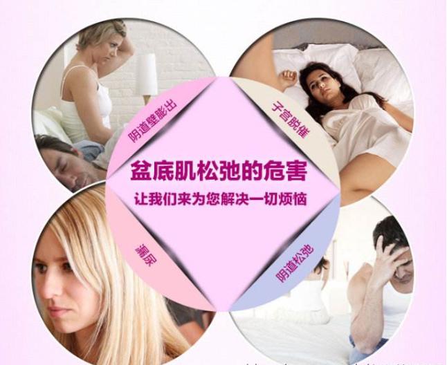 剖宫产有必要去医院做盆底康复吗,剖宫产需要做盆腔恢复吗