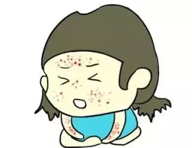 小儿湿疹民间偏方 (小儿湿疹止痒妙招)