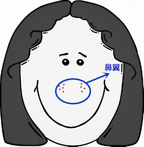 超全面面部痘痘分析图文，了解身体状况！