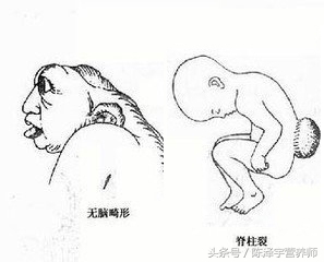 烟酸缺乏会有哪些症状,烟酸缺乏可引起什么