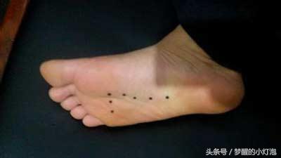 请嫁给有这五种痣相的男人,痣相看谁是极品旺妻男