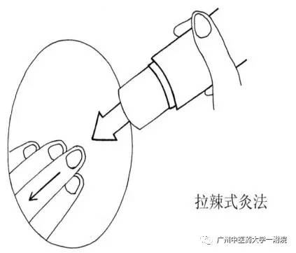 中医的雷火灸是治什么的,康复理疗吧