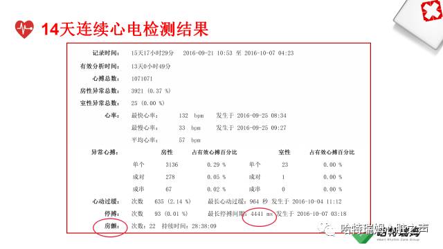「心声」长程心电检测设备在房颤管理中的重要地位