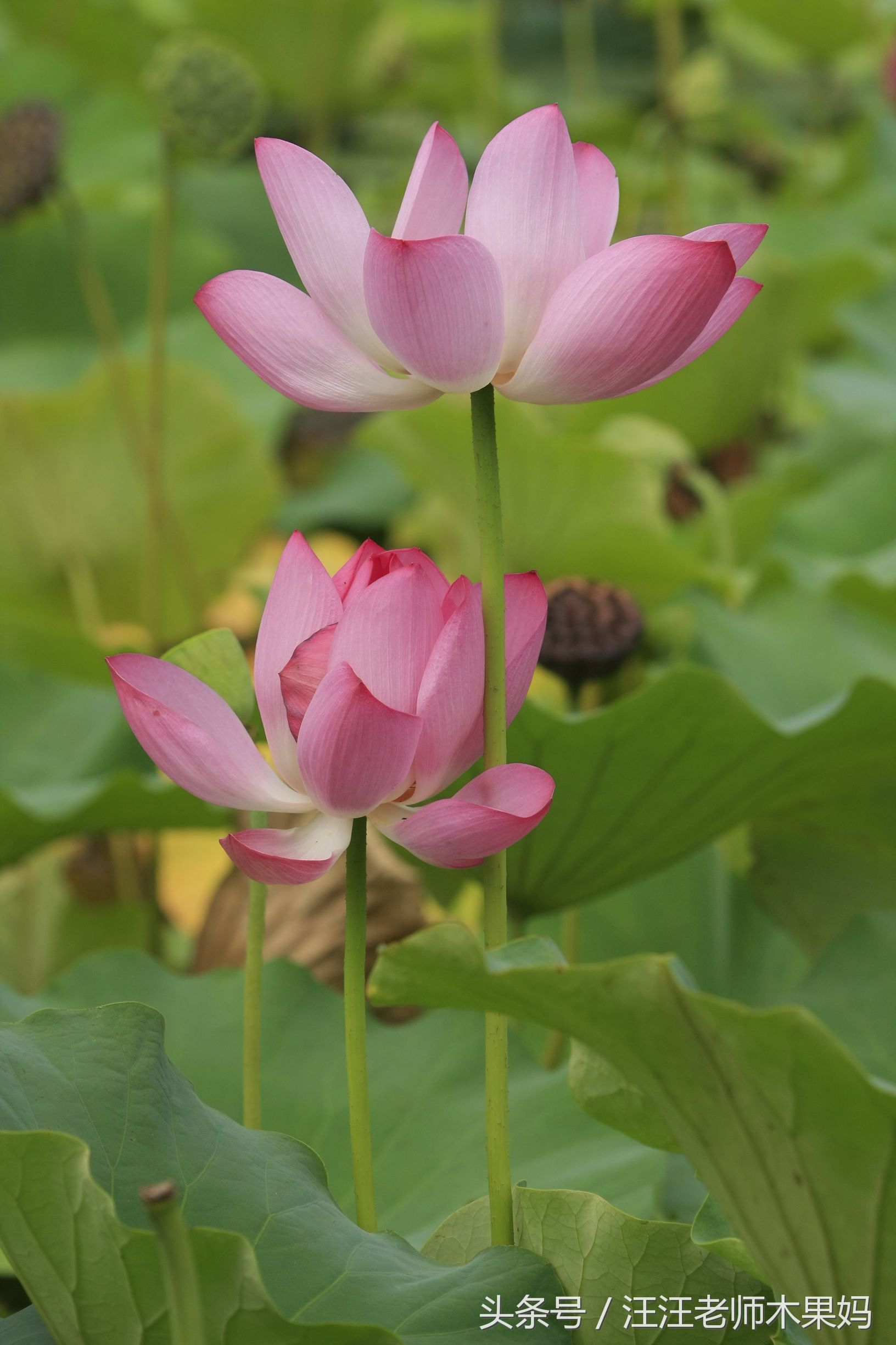 什么疼痛比生孩子还痛,什么痛比生孩子更痛