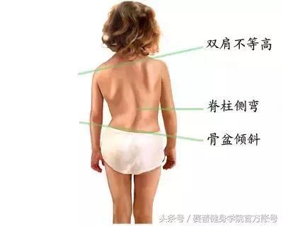 腹肌不对称的改善方法,腹肌两边不对称怎么办能继续练吗