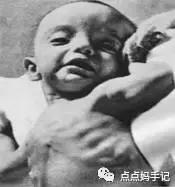 宝宝肋骨外翻怎么回事呀,宝宝肋骨外翻挂哪个科