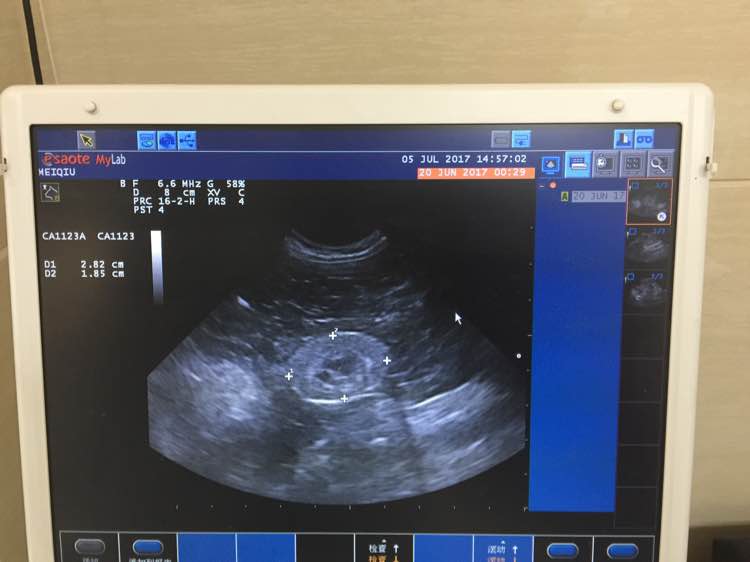 老猫肾结石,老猫得肾病