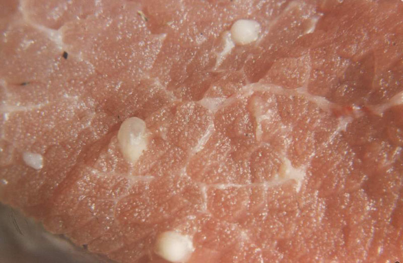 人感染猪囊虫病怎么办,人畜共患寄生虫病中的动物是什么