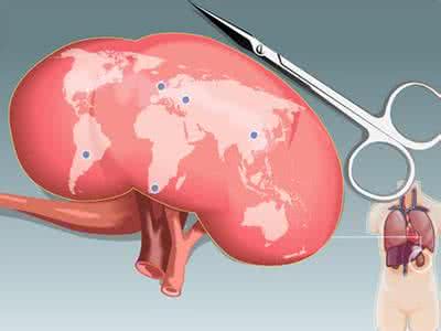 肾囊肿民间特别好偏方,张仲景土偏方治肾囊肿