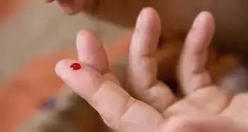 杨幂治掉头发防脱发,杨幂放血治感冒吗