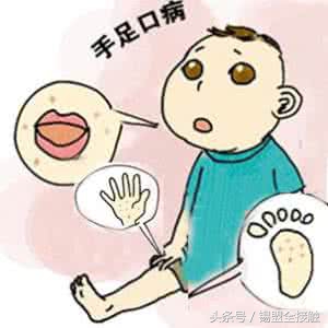 大人手上起了一个大水泡要当心了,手上起密密麻麻的小水泡是怎么了