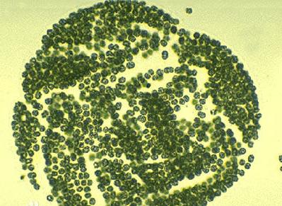 水体出现蓝藻怎么解决,水体蓝藻怎么治理