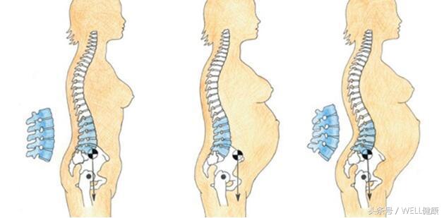 备孕腰椎间盘突出怎么办,腰椎间盘突出可以备孕吗