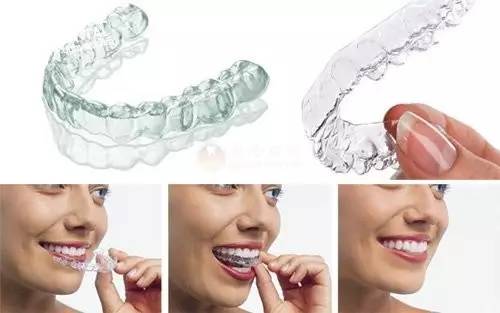 牙齿矫正特惠价3980,牙齿矫正特惠0元体验免费报名